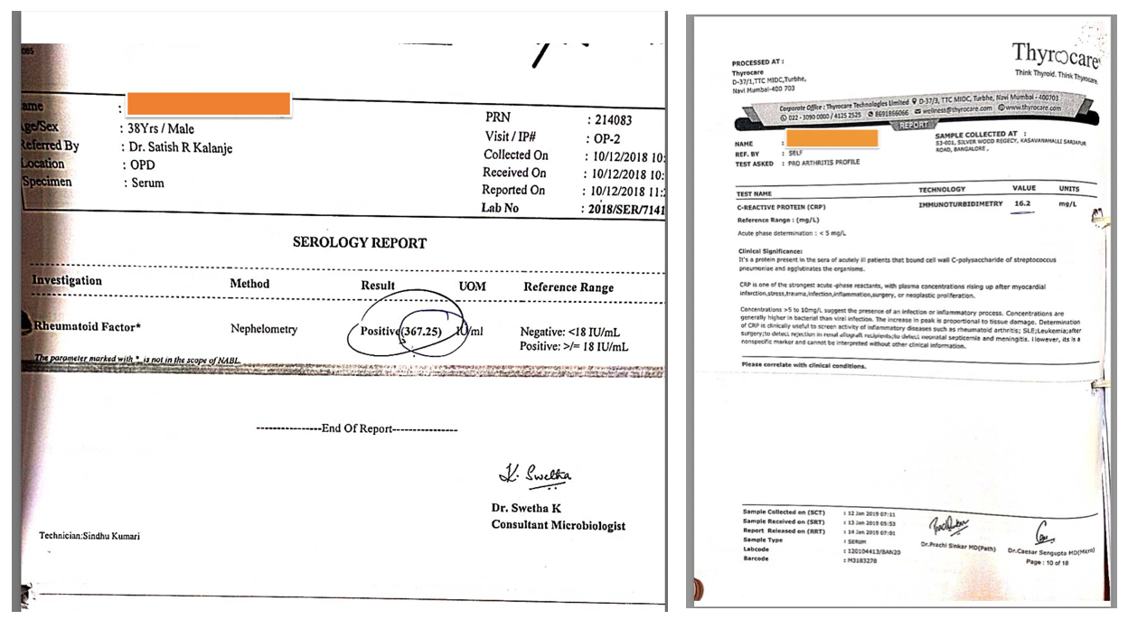 baseline_blood_reports_dated_10_12_2018.png