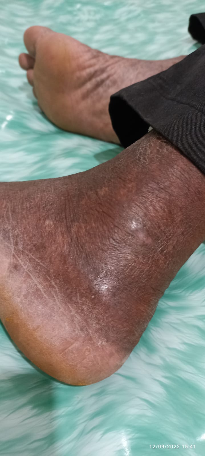 after_treatment_dated_22_6_2022.jpeg