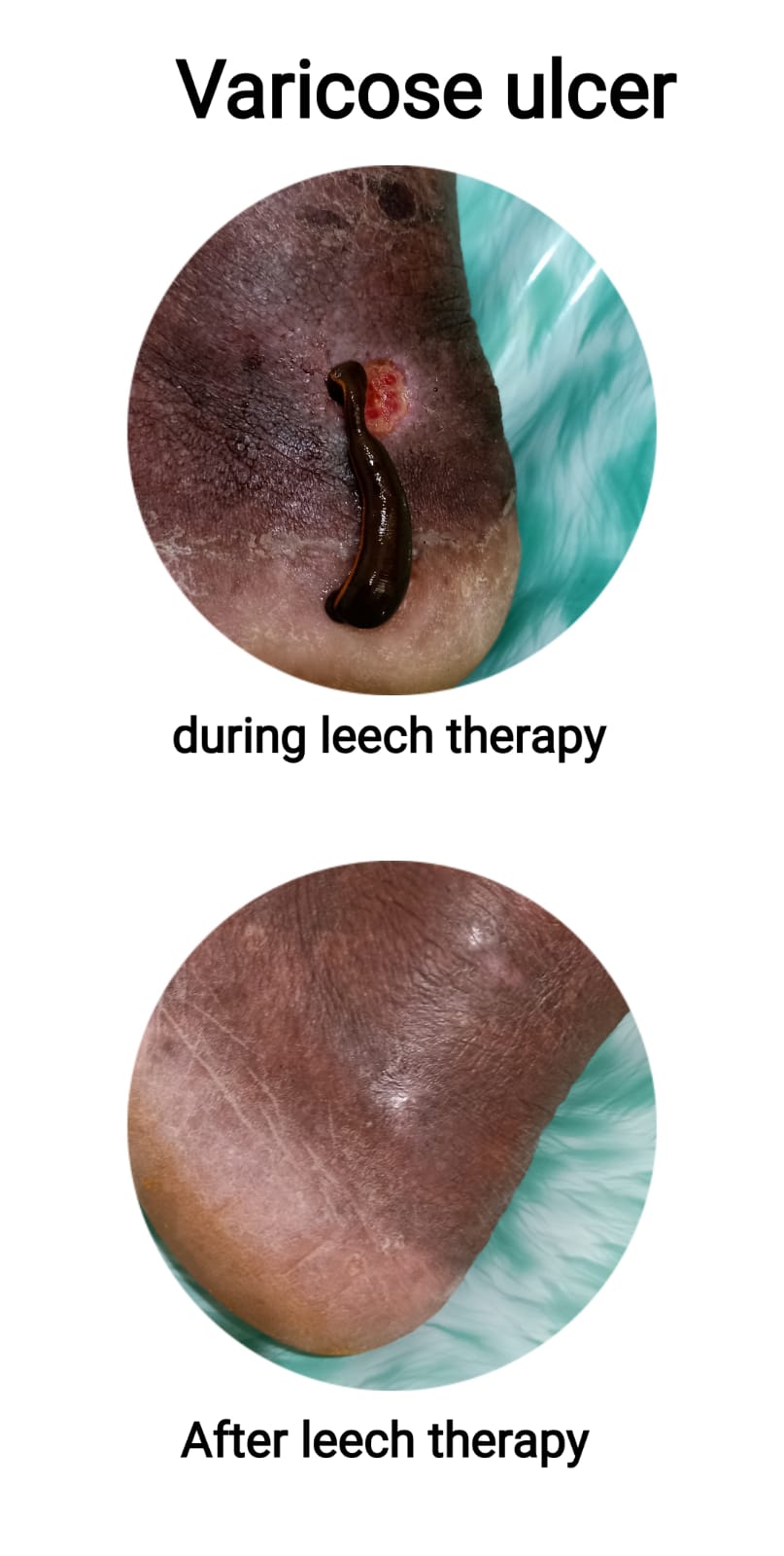 pre_and_post_treatment_images.jpeg