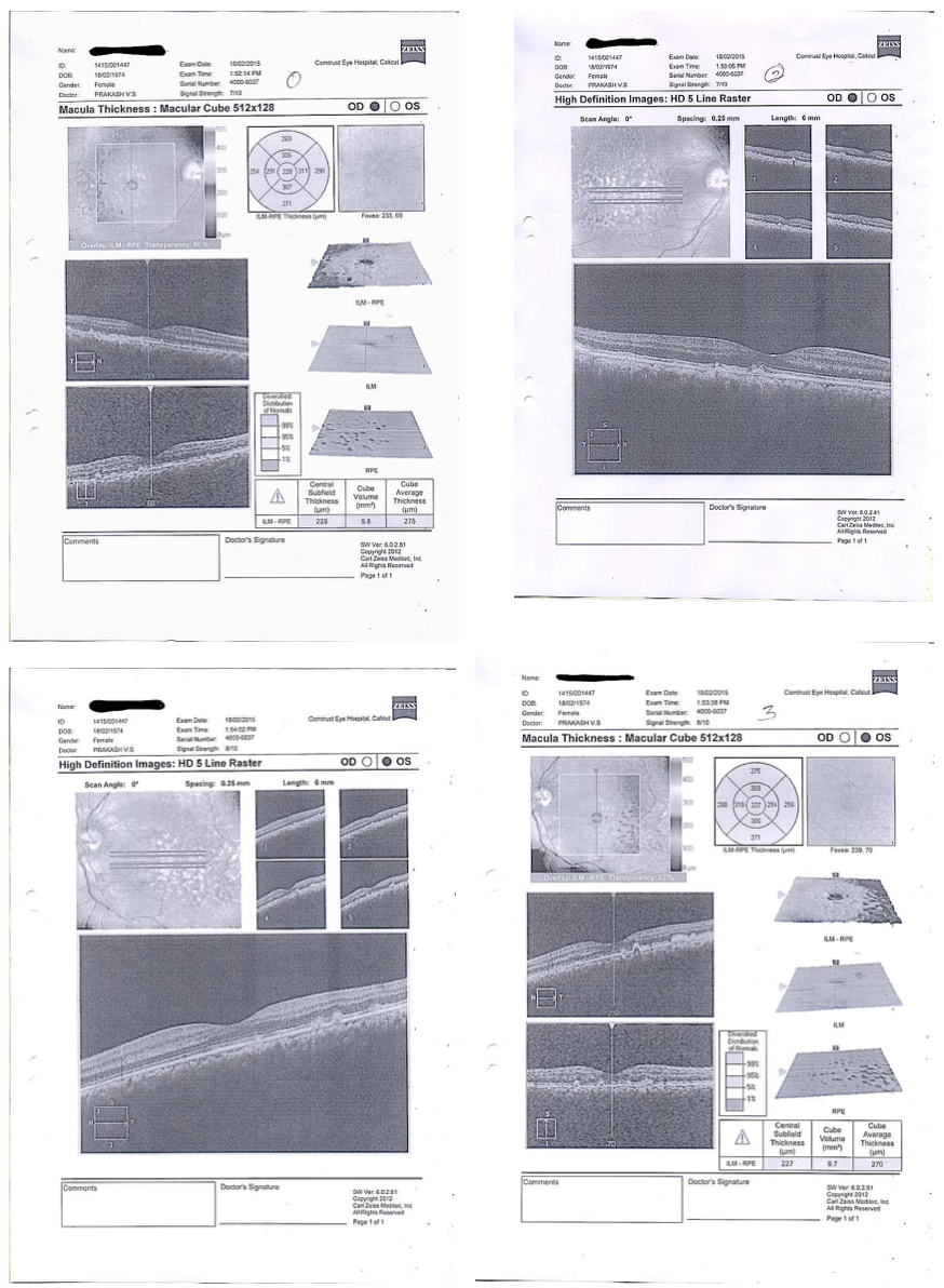 baseline_oct_images_dated_18_2_2015.png