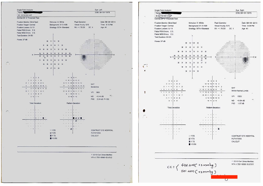 baseline_perimetry_reports_dated_2014.png