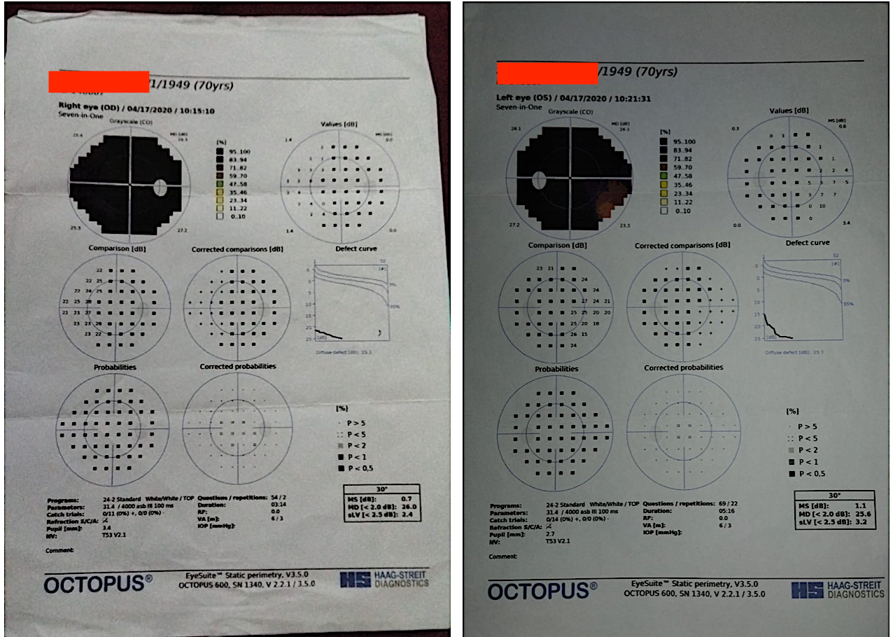 oct_reports_old_dated_17_4_2020.png