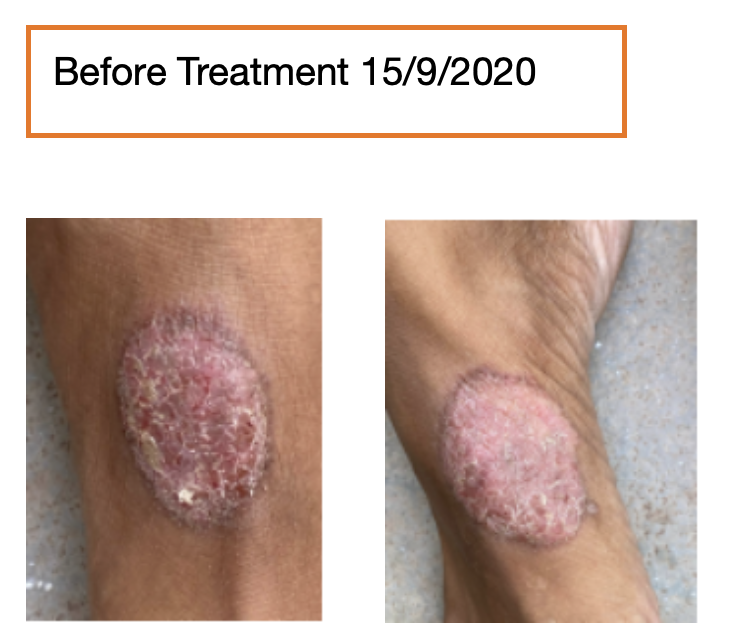 before_treatment.png