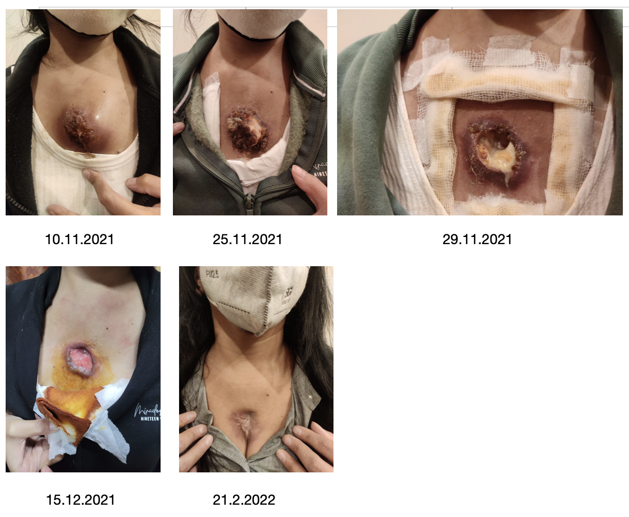 images_throughout_the_treatment.png