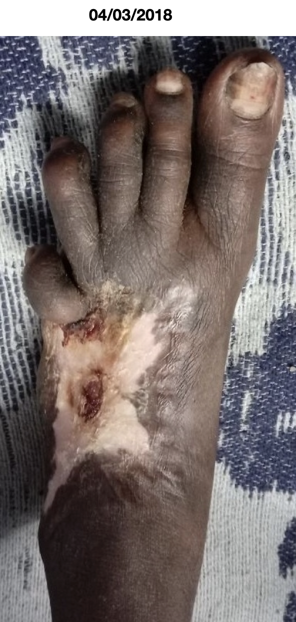 after_treatment_4_3_2018.png
