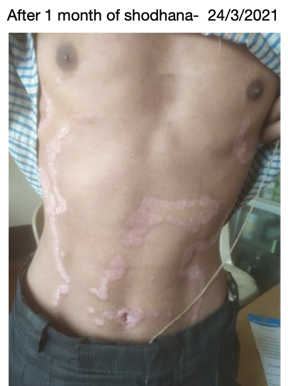 after_1_month_of_shodhana-_24_3_2021.png