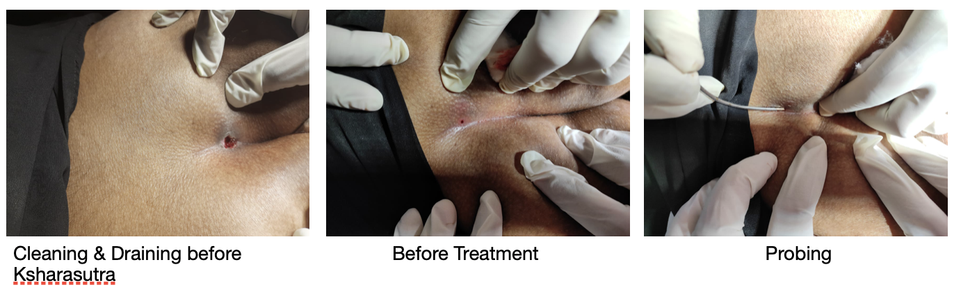 baseline_images_dated_14_9_2022.png