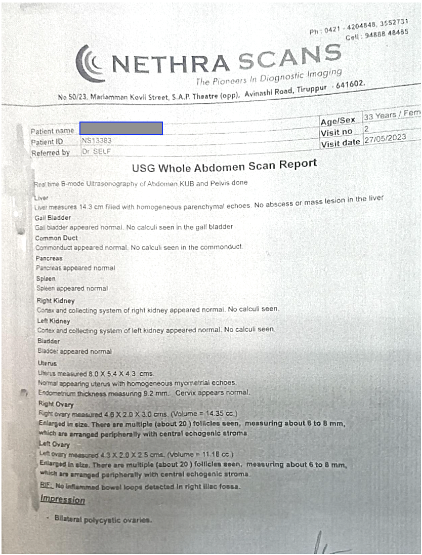 usg_done_after_treatment_dated_27_5_2023.png