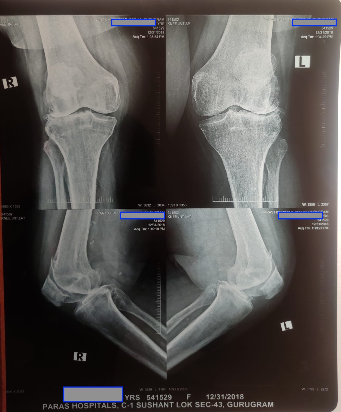 old_x_ray_dated_31_12_2018.jpeg