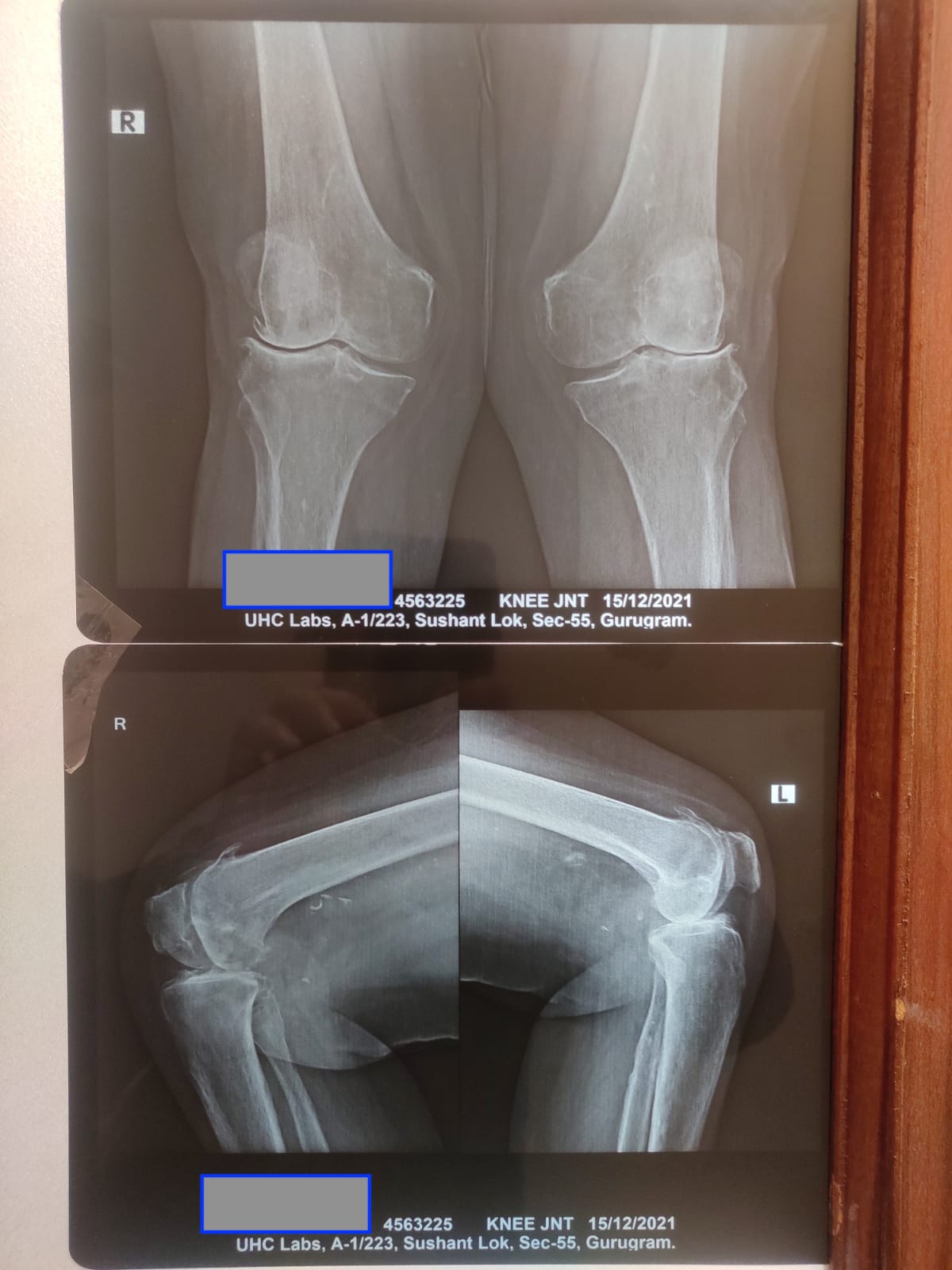 x_ray_during_treatment_dated_15_12_2021.jpeg