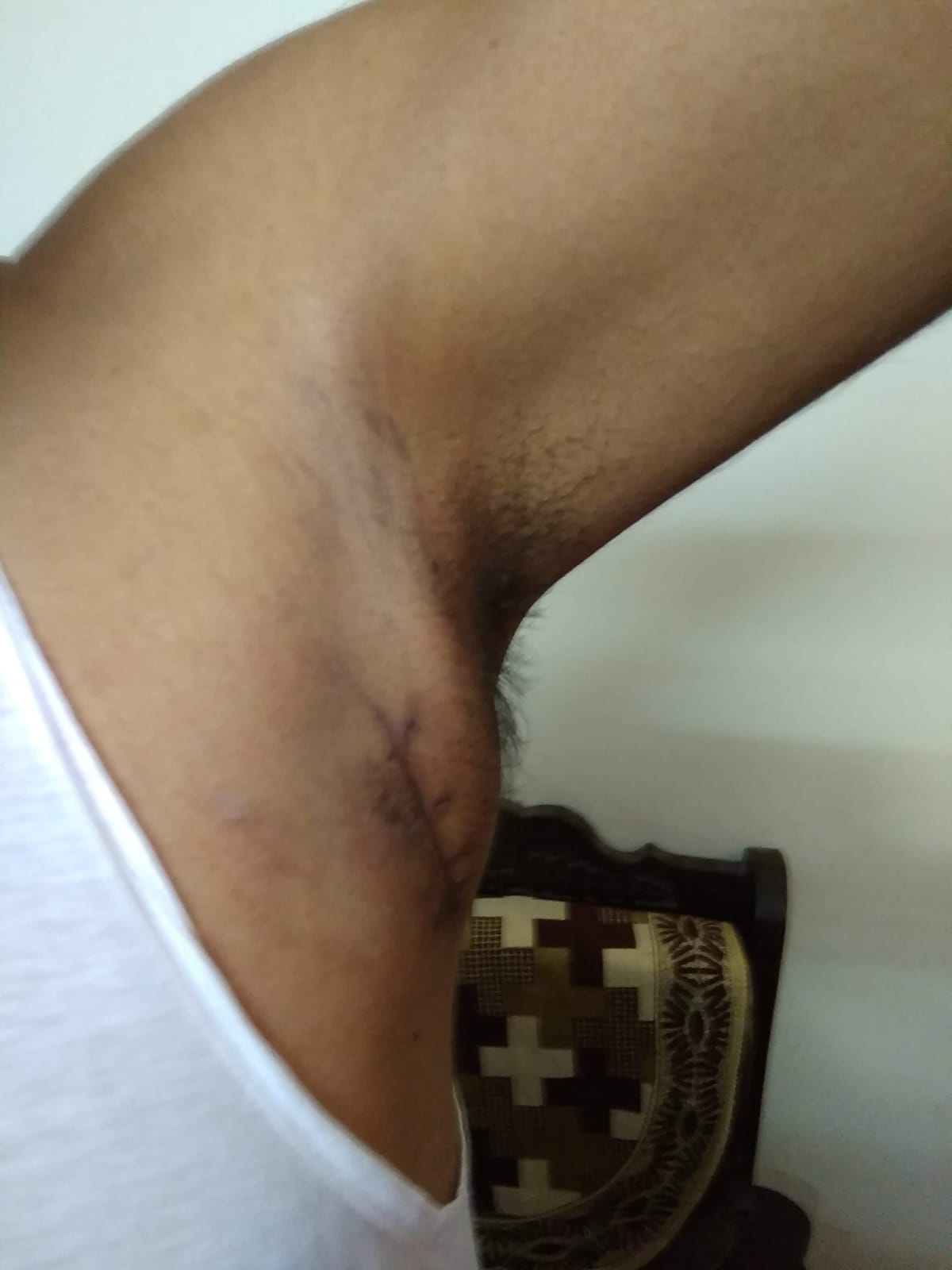 after_biopsy_dated_20_3_2019.jpg
