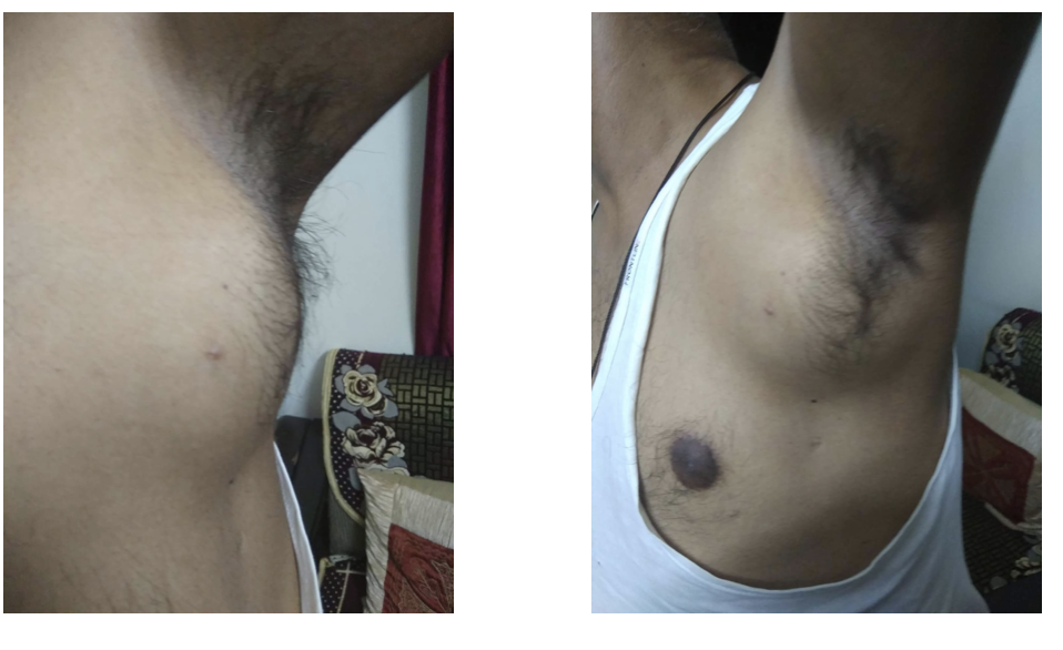 before_treatment.png