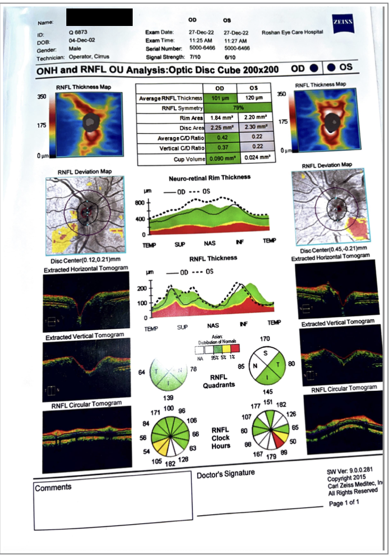 ohn_rfnl_-_ou_analysis_dated_27_12_2022.png