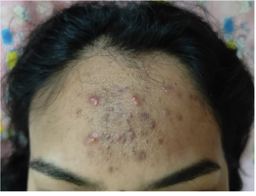 before_treatment_dated_6_7_2023.png