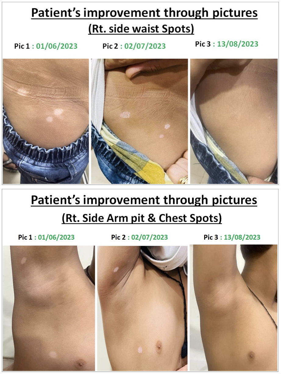 images_taken_throughout_treatment.png