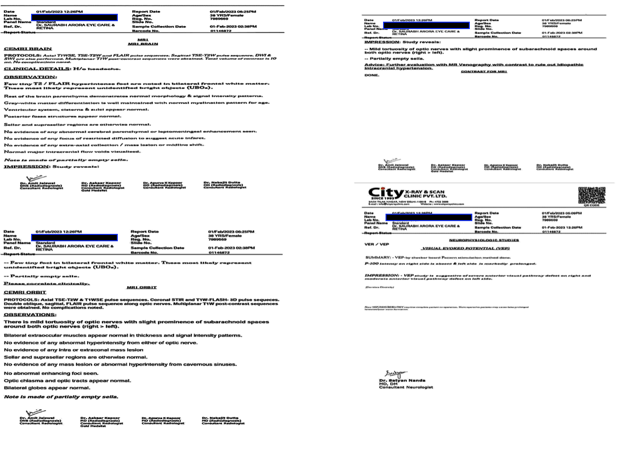 baseline_mri_report_dated_1_2_2023.png