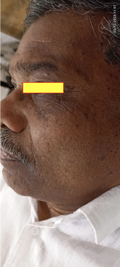 after_treatment_dated_2_12_2022.png