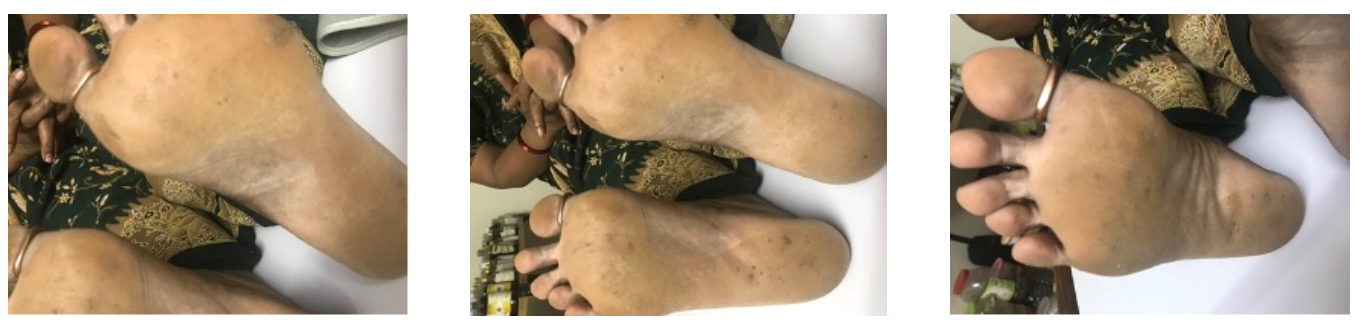 after_treatment_11_8_2018-1.png