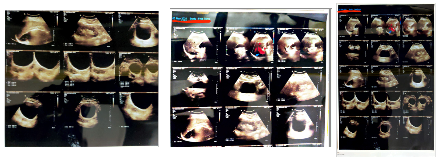 scan_images_may_2021.png