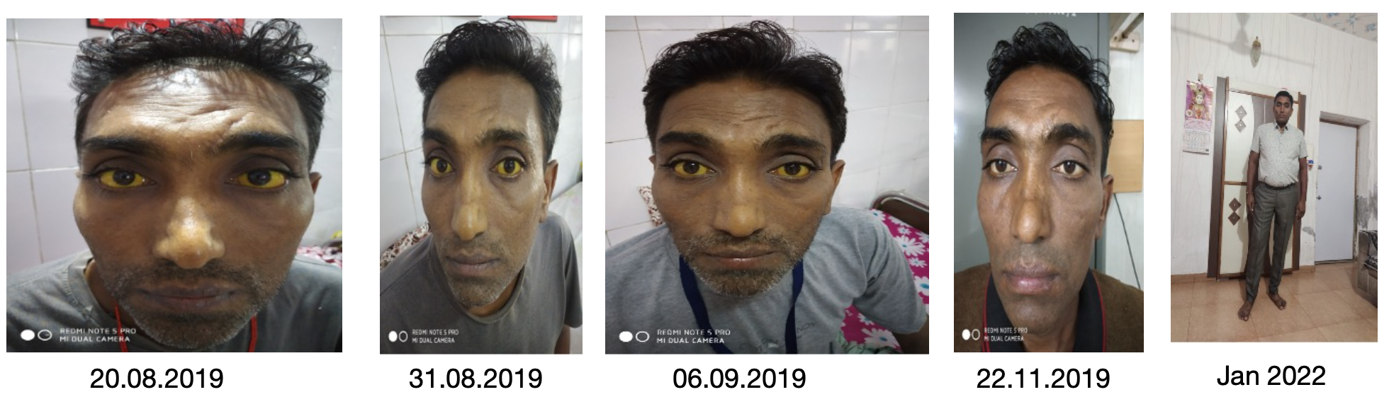 images_of_the_patient_baseline_to_endpoint.png