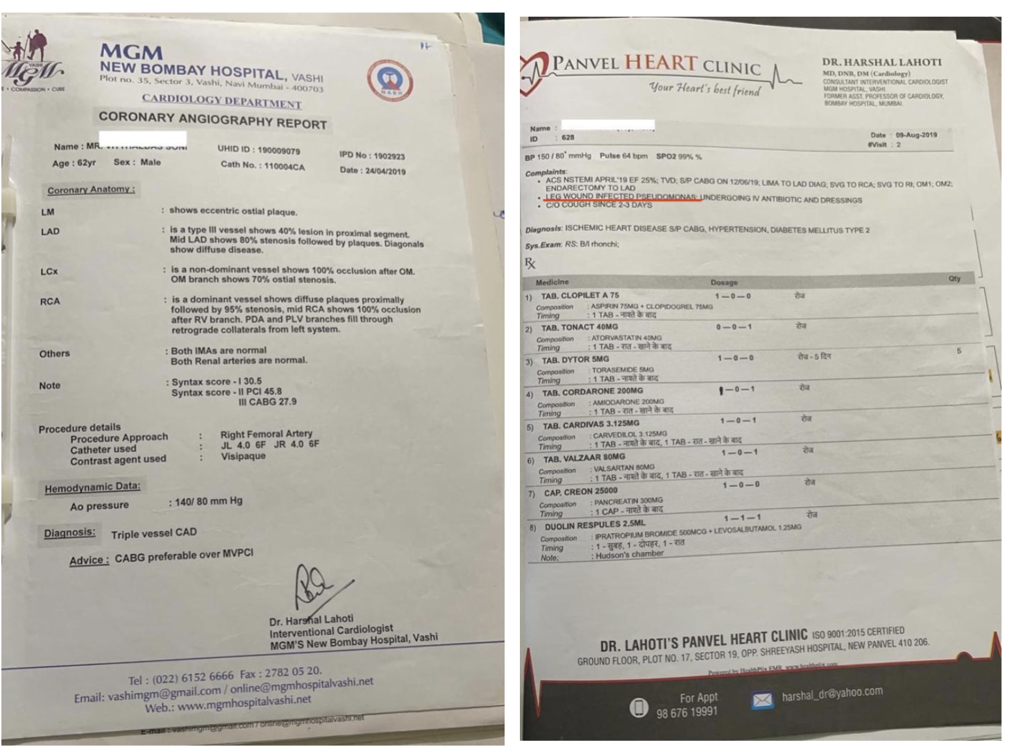 cabg_pre_treatment_record.png