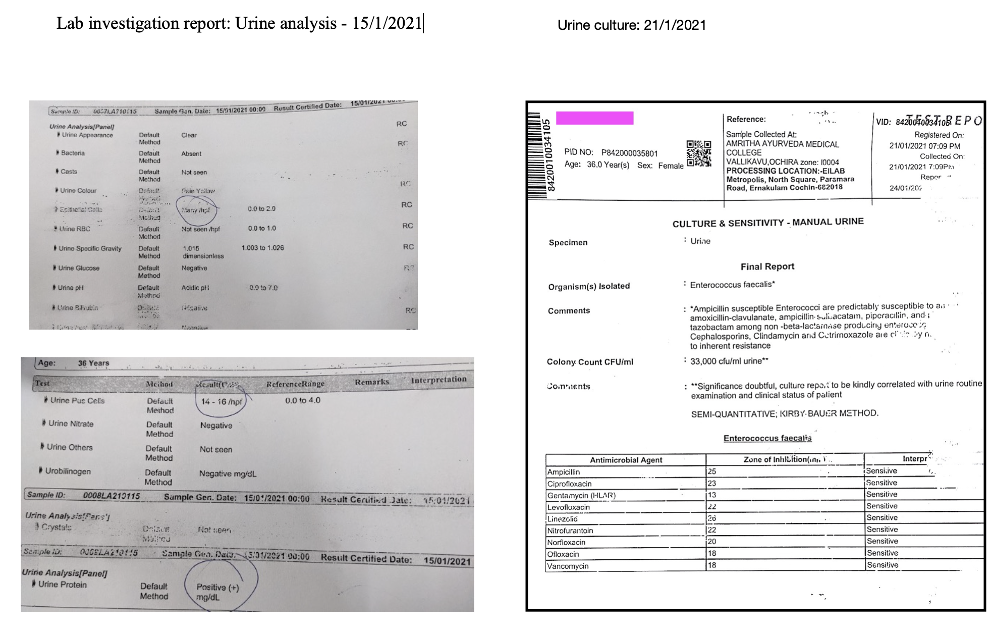 before_treatment_reports.png