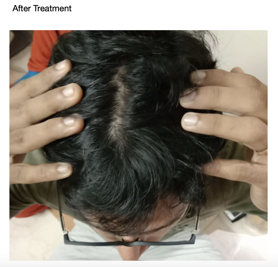 after_treatment_image.png