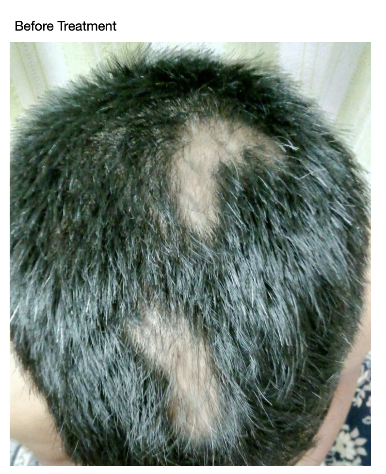 before_treatment_image.png