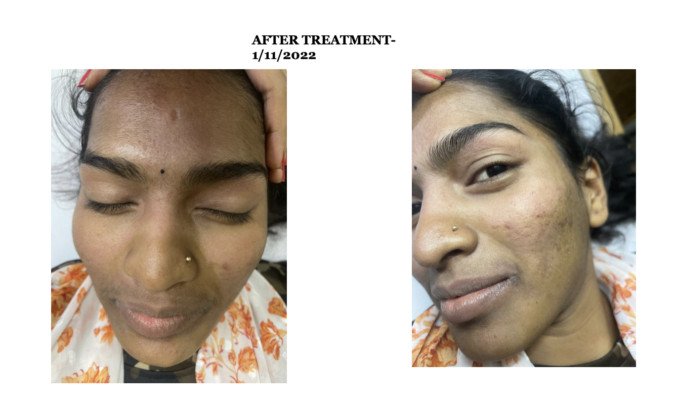 after_treatment_images.png