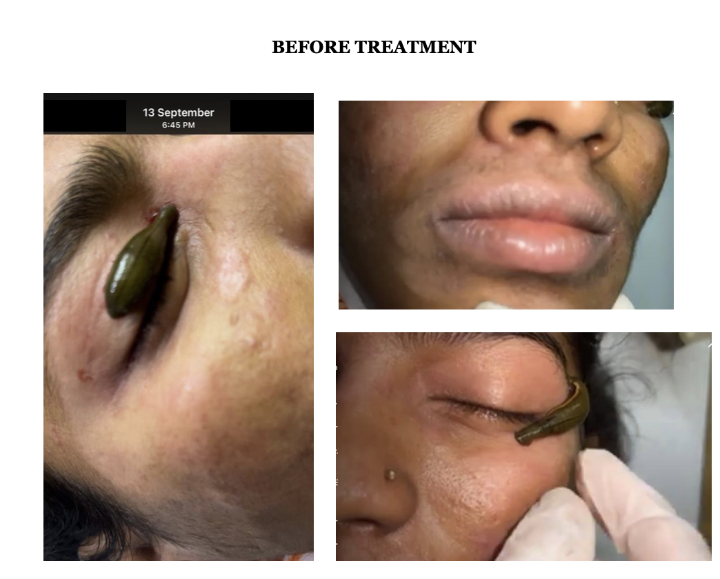 before_treatment_images.png