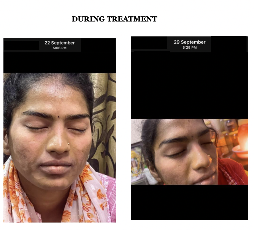 during_treatment_images.png