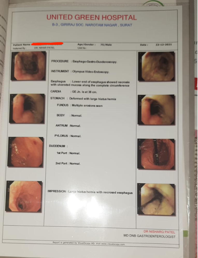 ogd_scope_at_baseline_22_12_2021.png