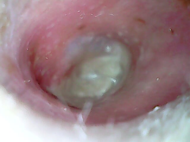 after_treatment_1-8-22.jpg