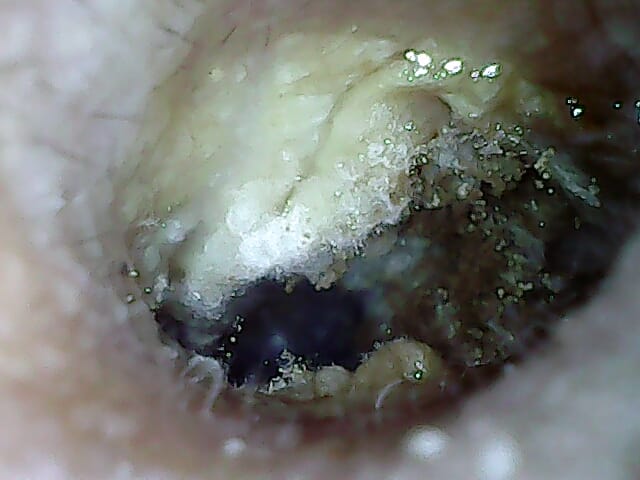 before_treatment_22-7-22.jpg
