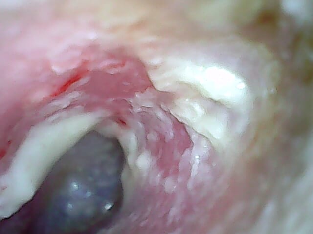 during_treatment_29-7-22.jpg