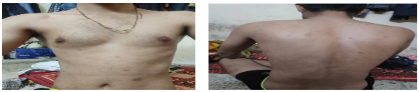 after_treatment_dated_1_3_2021.png