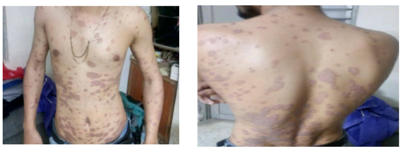 before_treatment_dated_15_8_2020.png